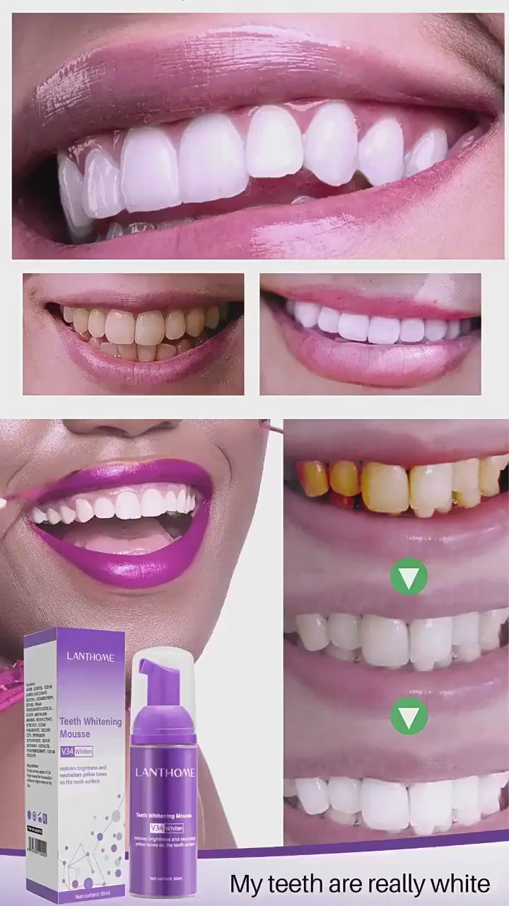 Toothpaste Mousse V34 - Your Solution to Teeth Cleaning, Whitening, and Stain Removal