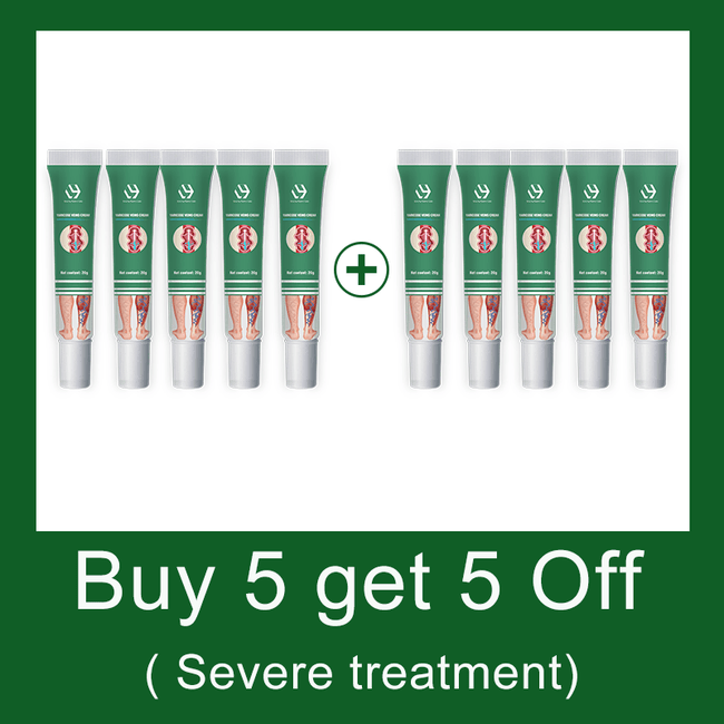 Varicose vein relief cream to relieve vasculitis phlebitis spider treatment - TheWellBeing4All