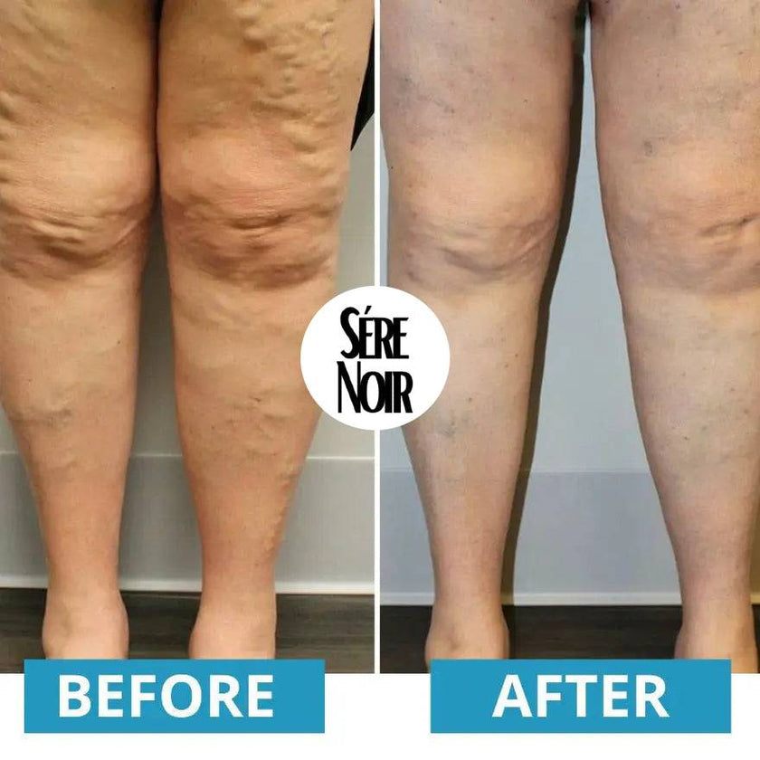 EMS Foot Massager - TheWellBeing4All